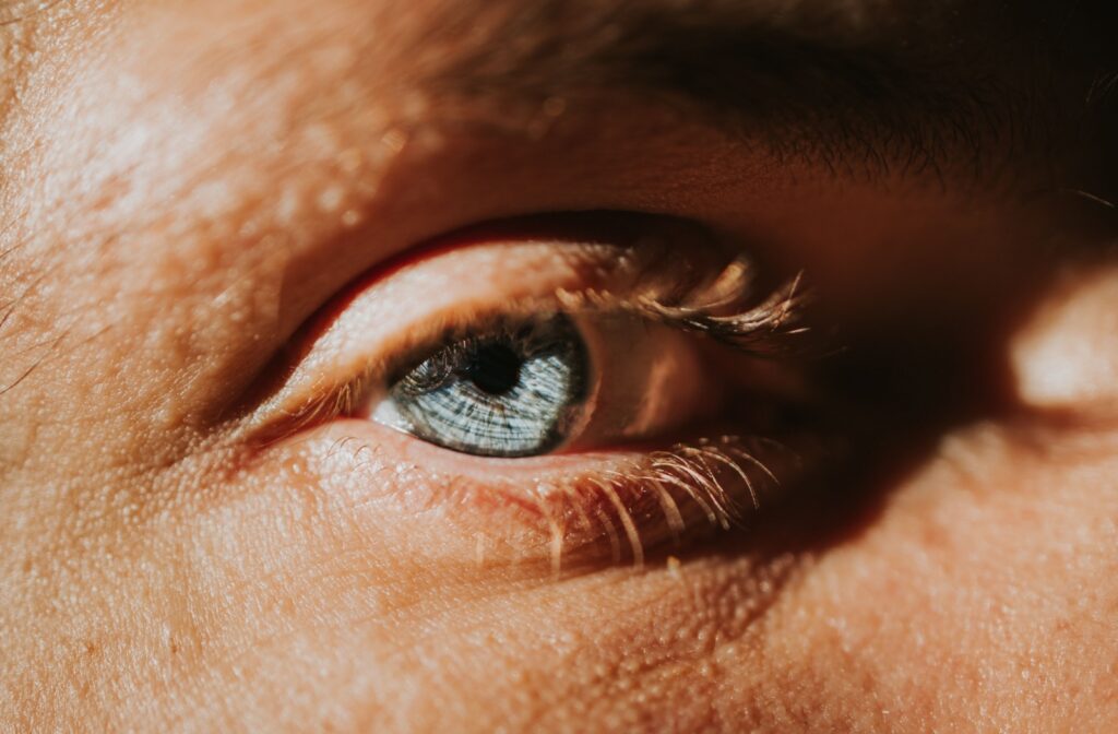 Close-up of a blue eye exposed to sunlight, representing potential sunburn or UV damage.